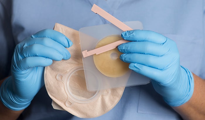 Ostomy Barriers: What They Are and What Purpose They Serve | Allied Medical Waste | Allied USA